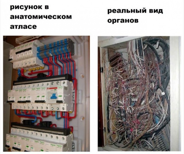 Черный юмор