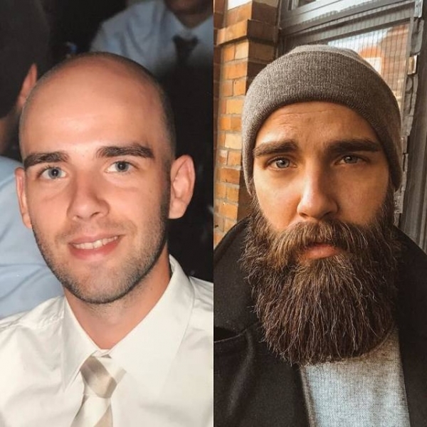 В кого превратится брутальный бородатый мужчина если сбрить бороду