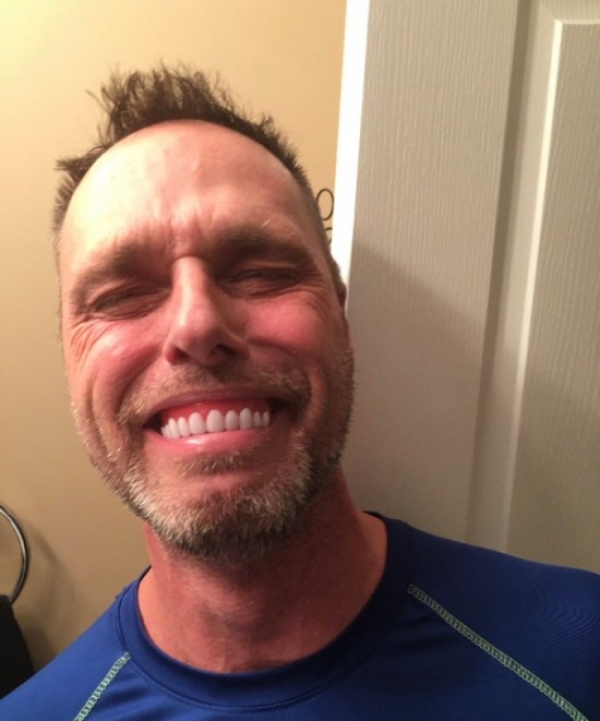 Голливудская улыбка из Алиэкспресс