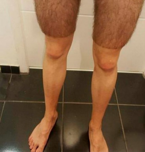 На грани нервного срыва